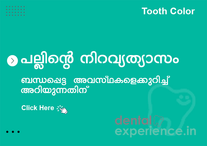 Types Of Tooth Discoloration